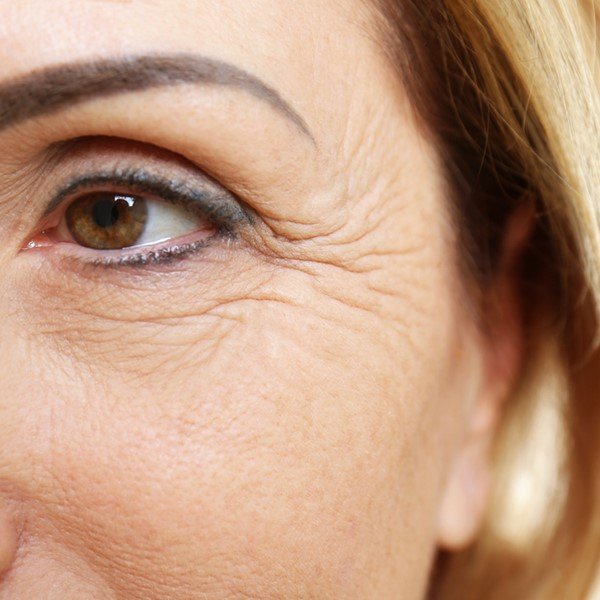 Anti-wrinkle treatment